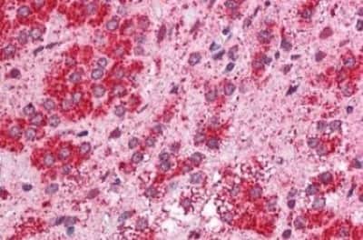 Immunohistochemistry-Paraffin: TMEM33 Antibody [NBP3-14500] - TMEM33 antibody IHC of human adrenal. Immunohistochemistry of formalin-fixed, paraffin-embedded tissue after heat-induced antigen retrieval.